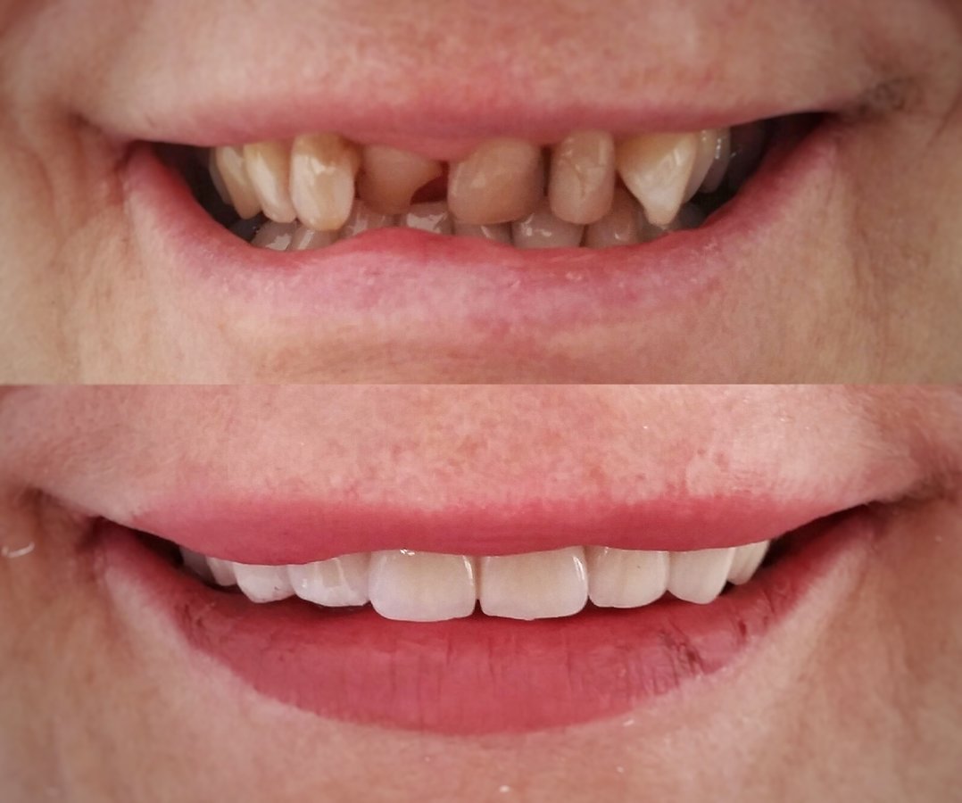 Side Dental Centre - Side Dental Centre