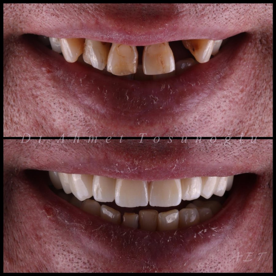 Side Dental Centre - Side Dental Centre