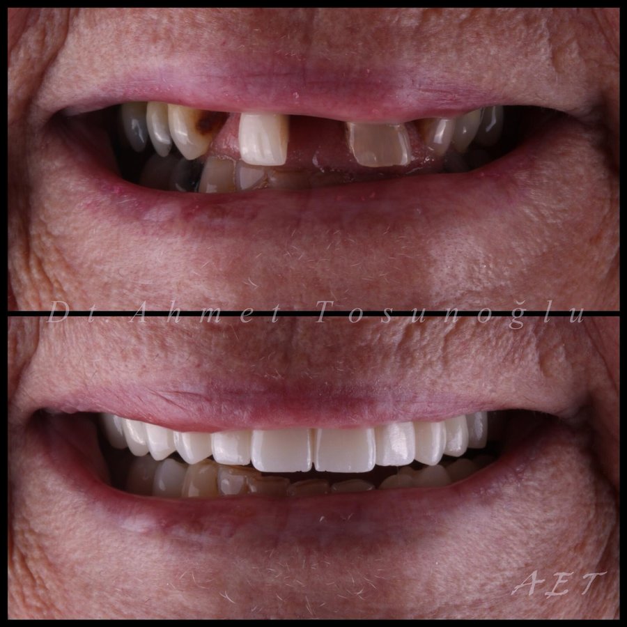 Side Dental Centre - Side Dental Centre