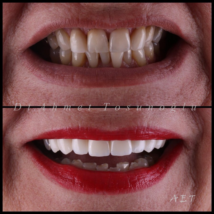 Side Dental Centre - Side Dental Centre