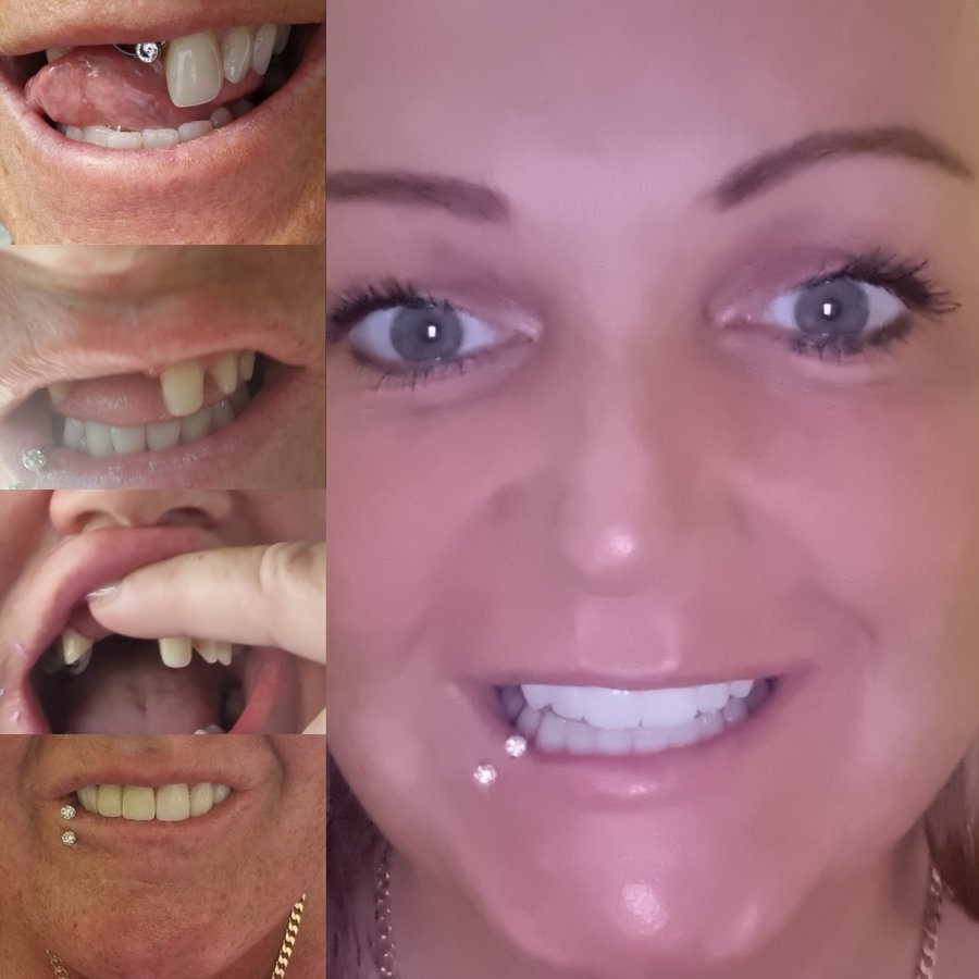 Side Smile Dental Clinic - Side Smile Dental Clinic