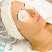 Silkor Laser Hair Removal - Waab - Silkor Laser Hair Removal - Waab