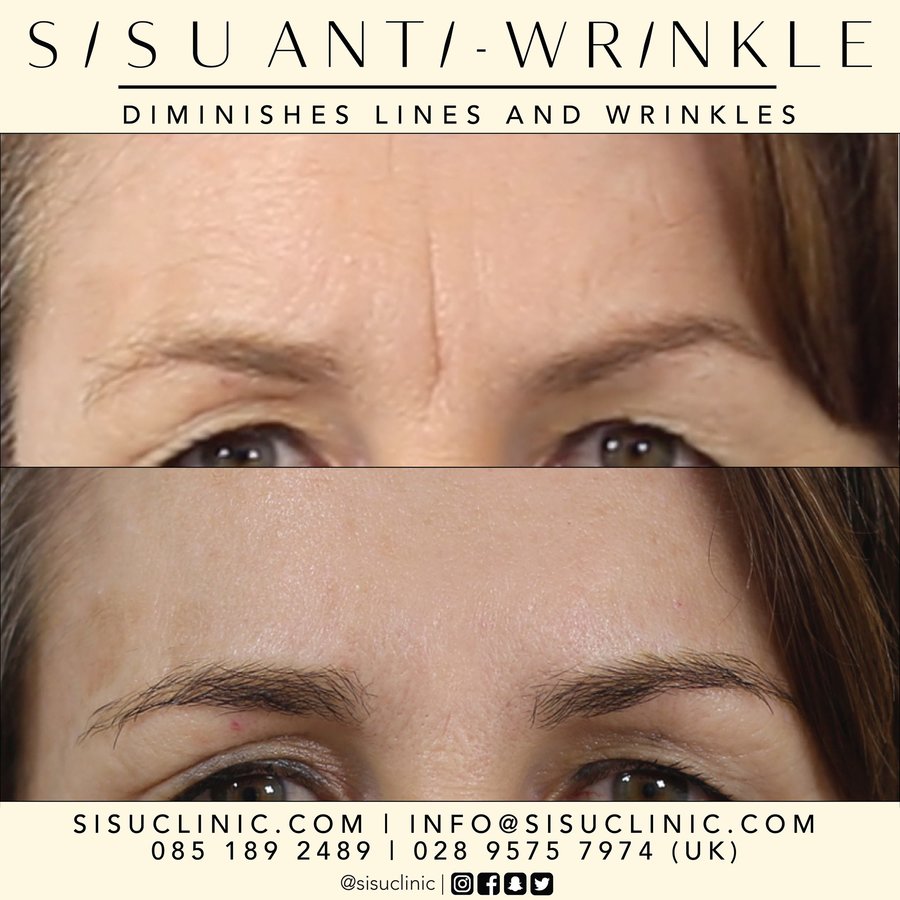 SISU Aesthetic Clinic - Cork - SISU Aesthetic Clinic - Cork