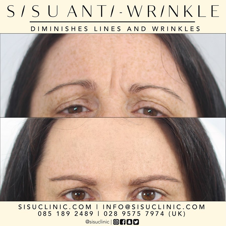 SISU Aesthetic Clinic - Cork - SISU Aesthetic Clinic - Cork