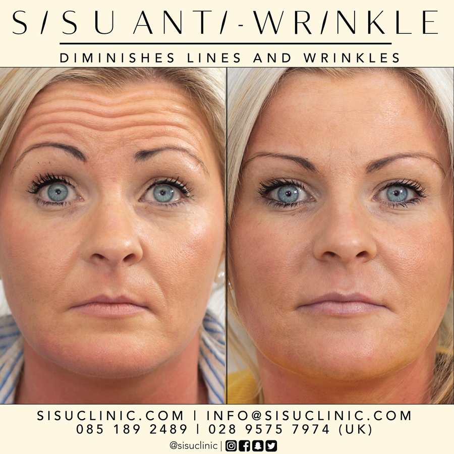 SISU Aesthetic Clinic - Cork - SISU Aesthetic Clinic - Cork