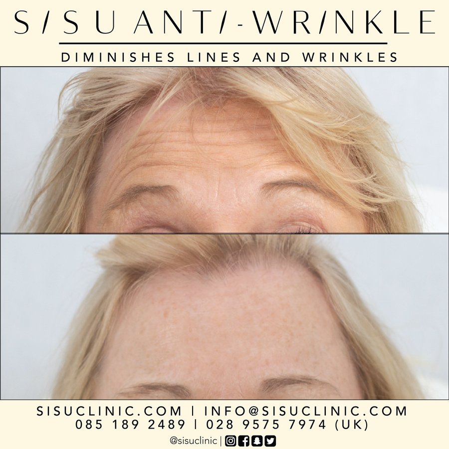 SISU Aesthetic Clinic - Cork - SISU Aesthetic Clinic - Cork