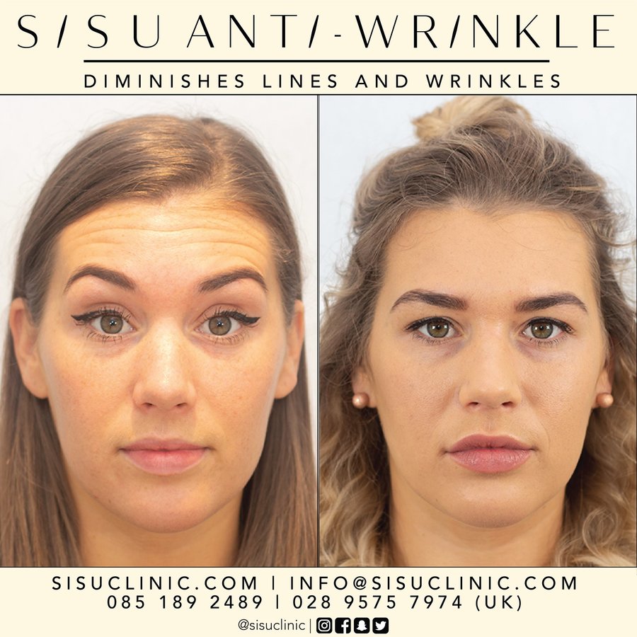 SISU Aesthetic Clinic - Cork - SISU Aesthetic Clinic - Cork