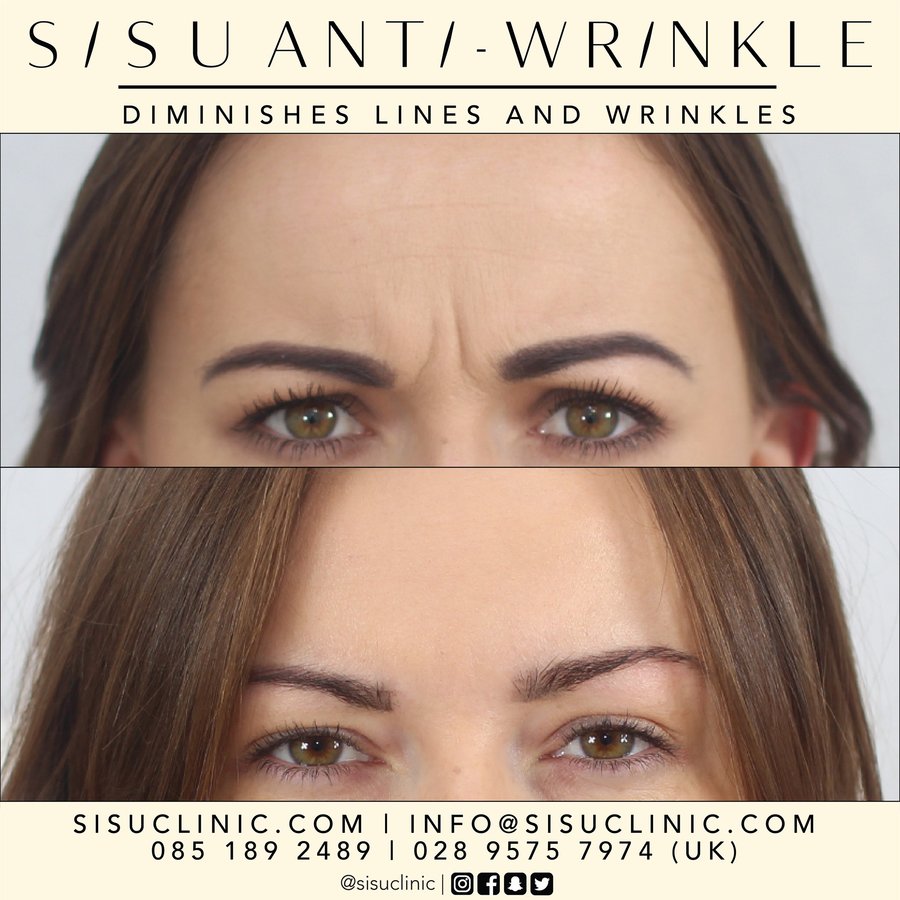 SISU Aesthetic Clinic - Cork - SISU Aesthetic Clinic - Cork