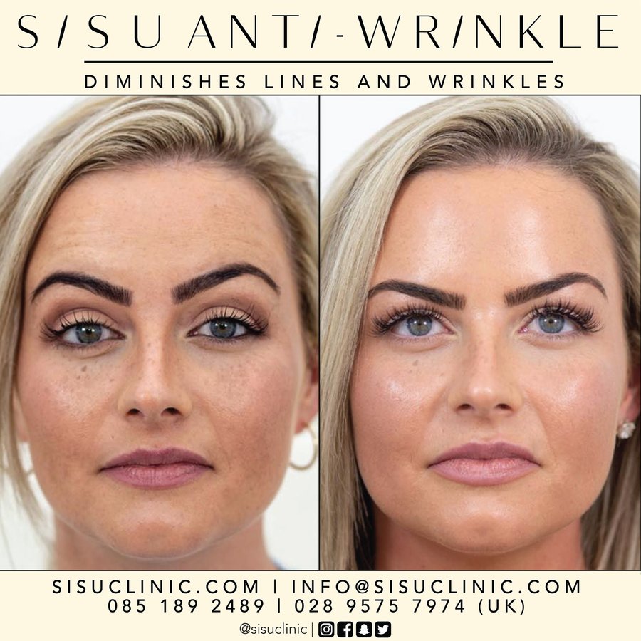 SISU Aesthetic Clinic - Cork - SISU Aesthetic Clinic - Cork