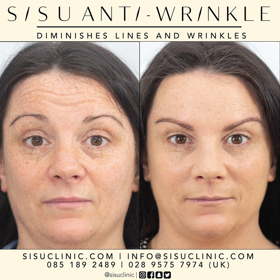 SISU Aesthetic Clinic - Cork - SISU Aesthetic Clinic - Cork