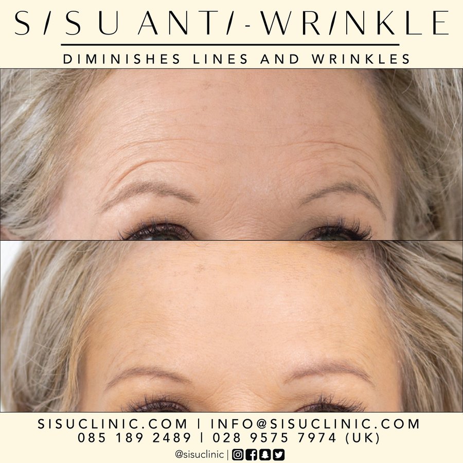 SISU Aesthetic Clinic - Cork - SISU Aesthetic Clinic - Cork