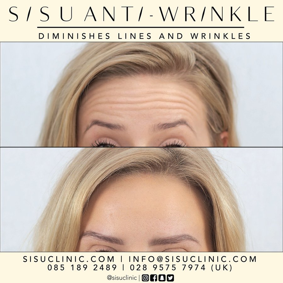 SISU Aesthetic Clinic - Cork - SISU Aesthetic Clinic - Cork