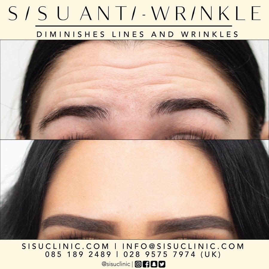 SISU Aesthetic Clinic - Cork - SISU Aesthetic Clinic - Cork