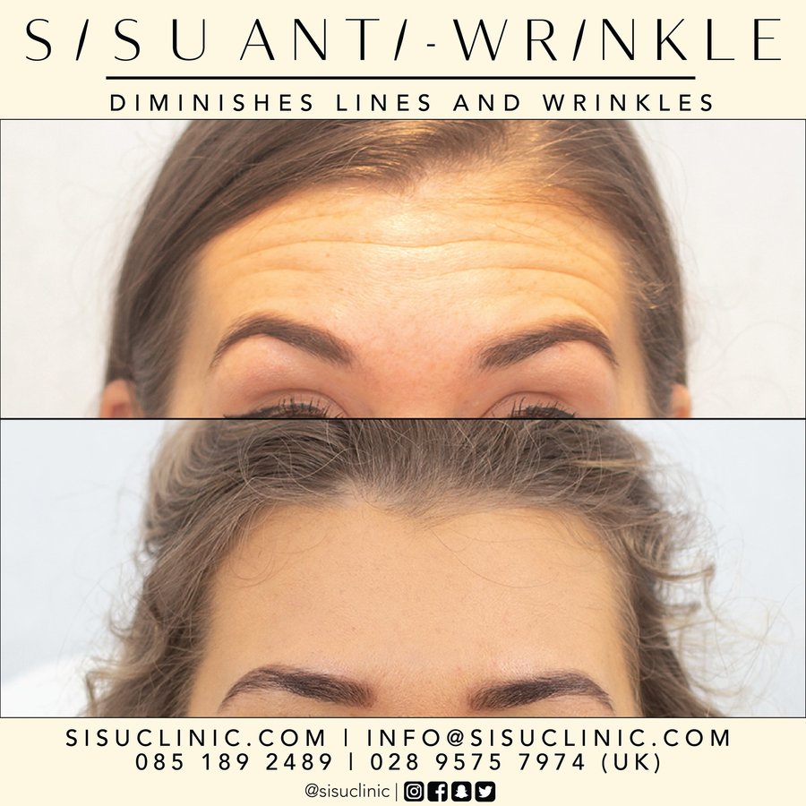 SISU Aesthetic Clinic - Cork - SISU Aesthetic Clinic - Cork