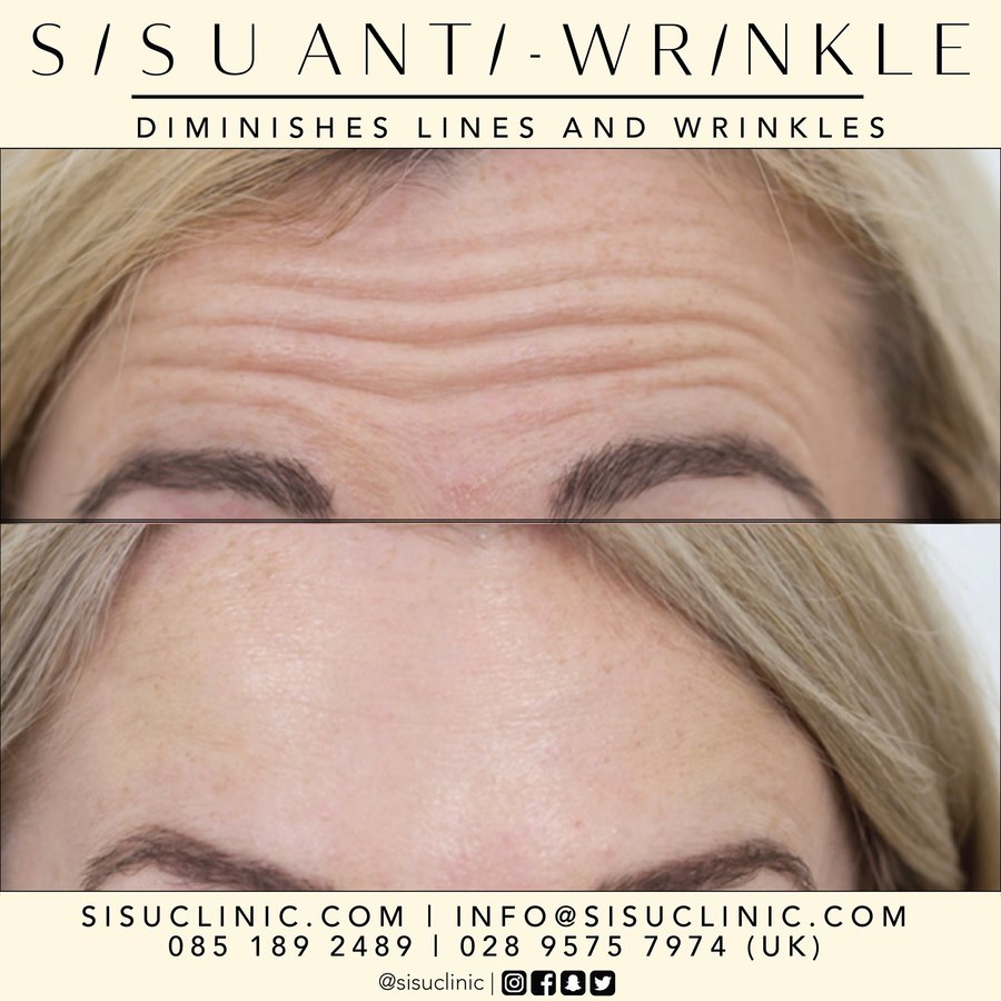 SISU Aesthetic Clinic - Cork - SISU Aesthetic Clinic - Cork