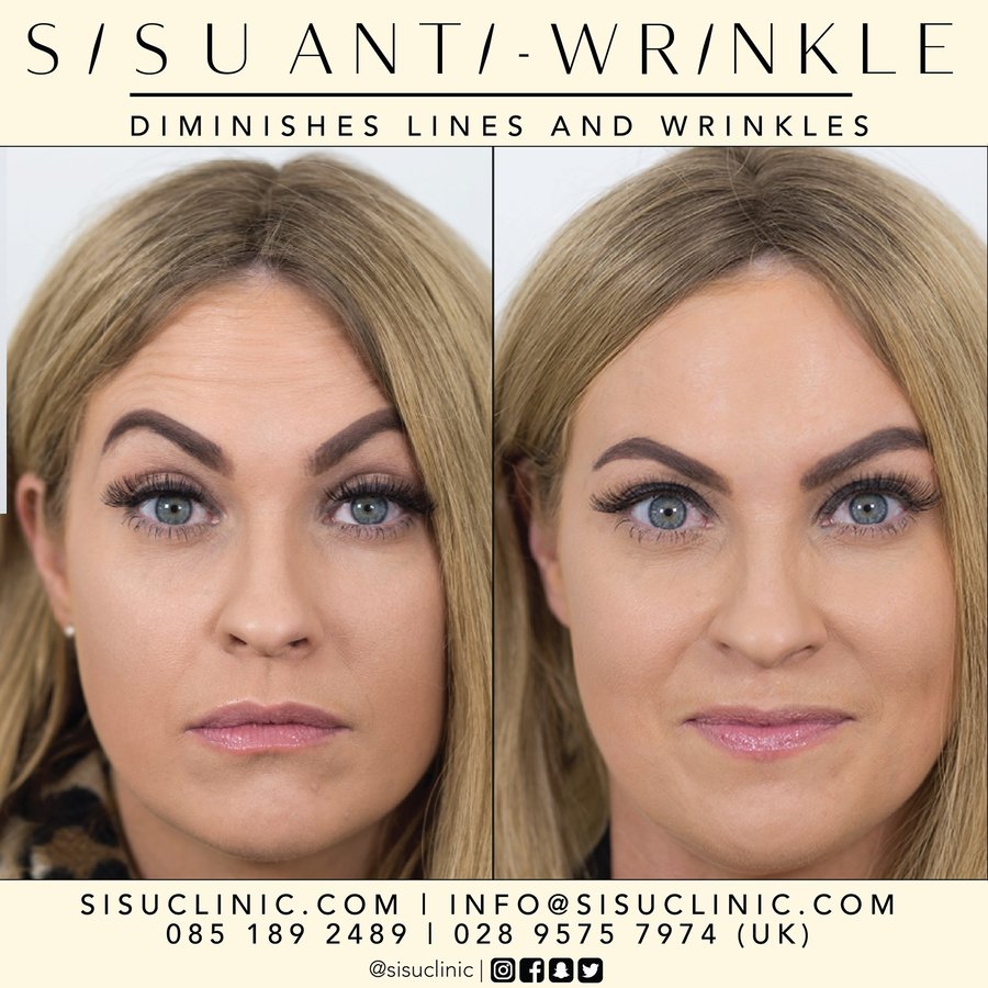 SISU Aesthetic Clinic - Cork - SISU Aesthetic Clinic - Cork