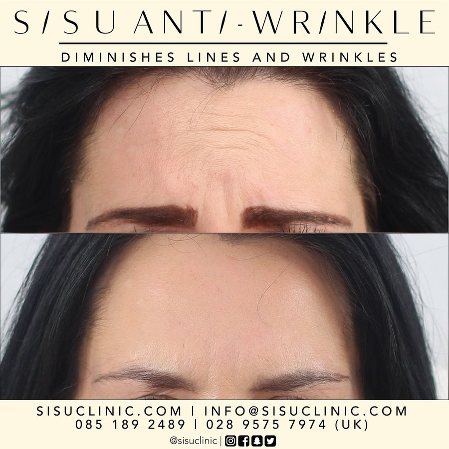 SISU Aesthetic Clinic - Cork - SISU Aesthetic Clinic - Cork