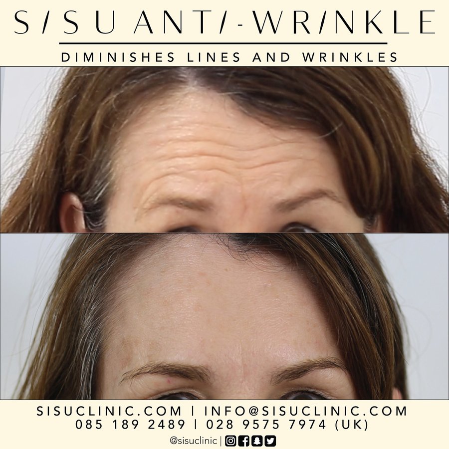 SISU Aesthetic Clinic - Cork - SISU Aesthetic Clinic - Cork