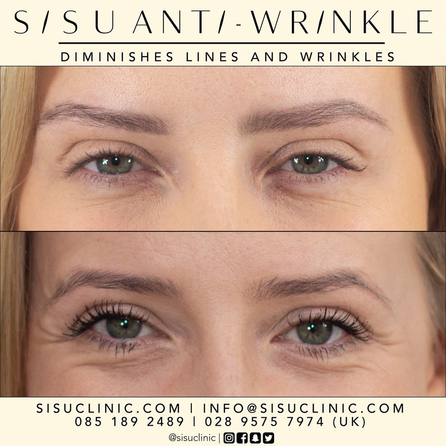 SISU Aesthetic Clinic - Cork - SISU Aesthetic Clinic - Cork