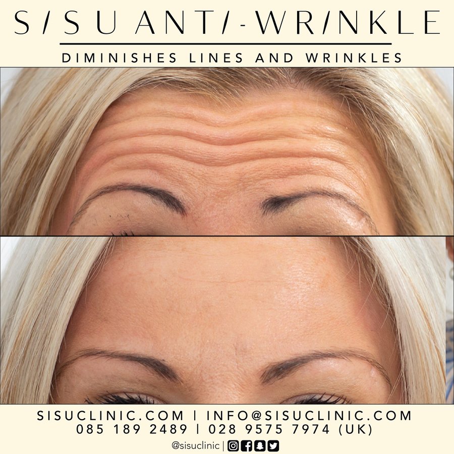 SISU Aesthetic Clinic - Cork - SISU Aesthetic Clinic - Cork