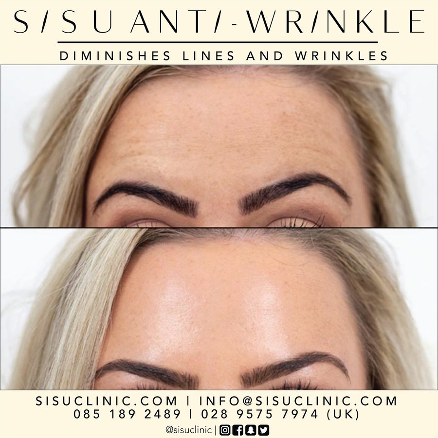 SISU Aesthetic Clinic - Cork - SISU Aesthetic Clinic - Cork