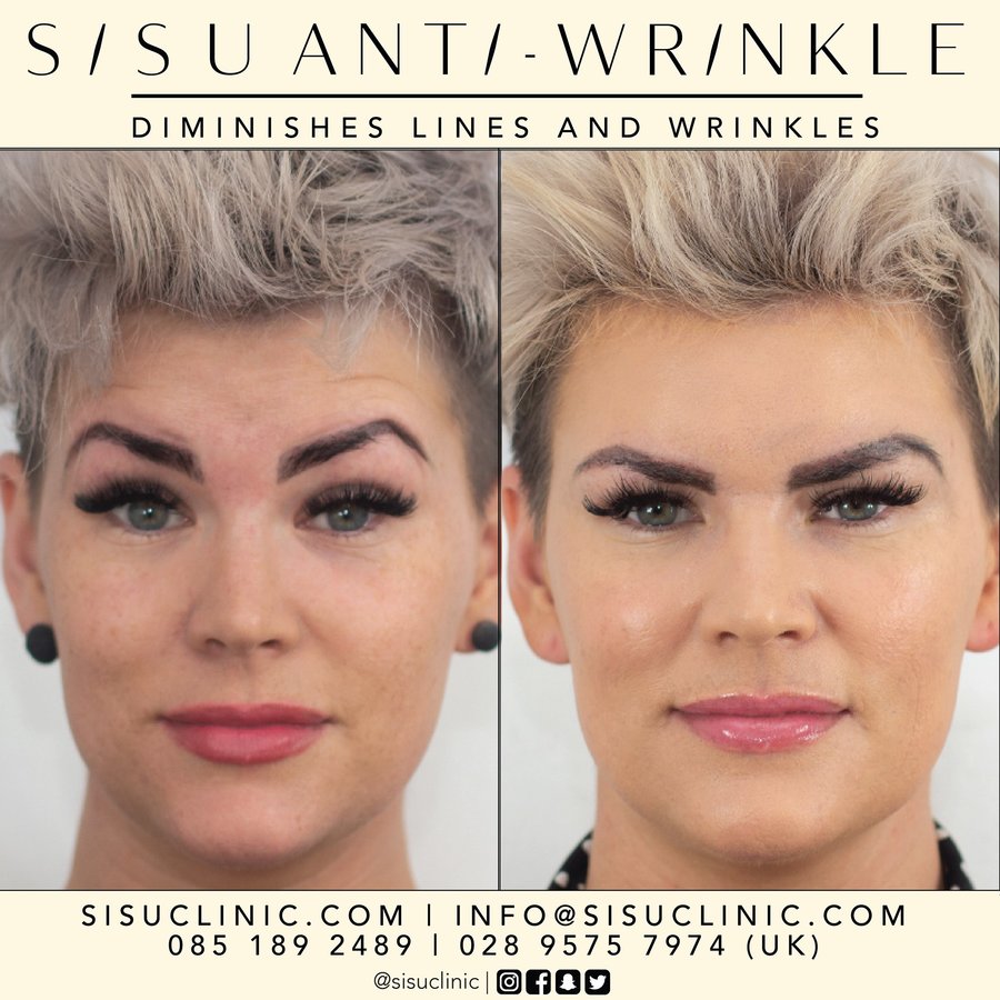 SISU Aesthetic Clinic - Cork - SISU Aesthetic Clinic - Cork