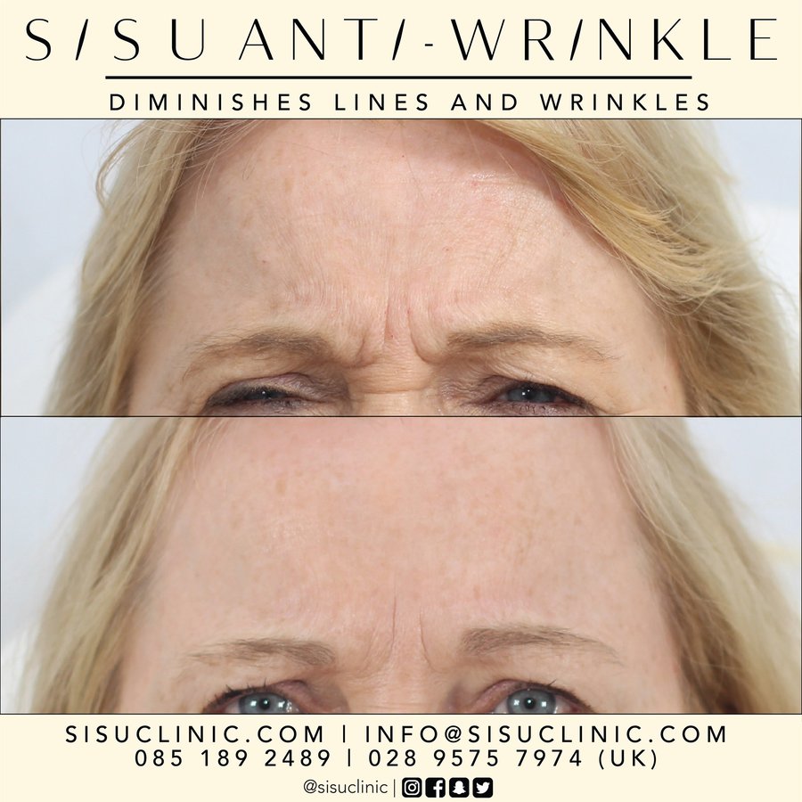 SISU Aesthetic Clinic - Cork - SISU Aesthetic Clinic - Cork