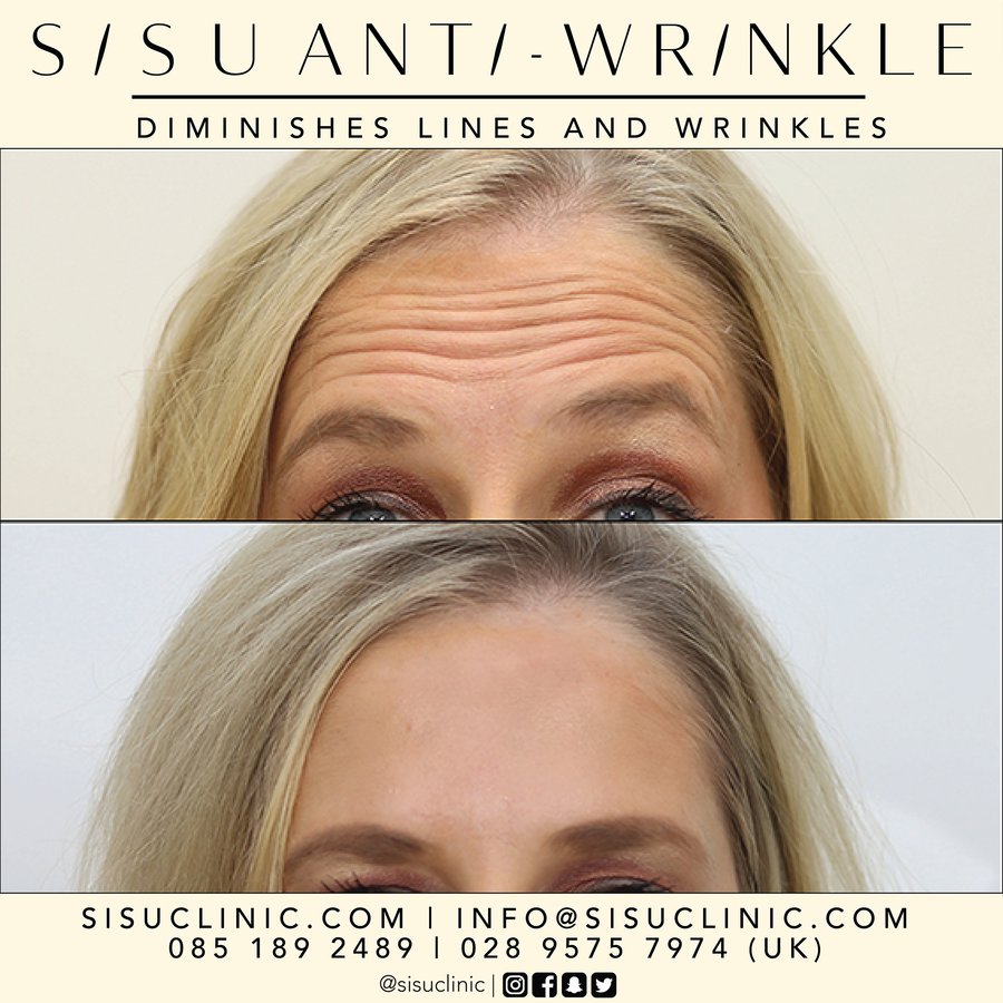 SISU Aesthetic Clinic - Cork - SISU Aesthetic Clinic - Cork