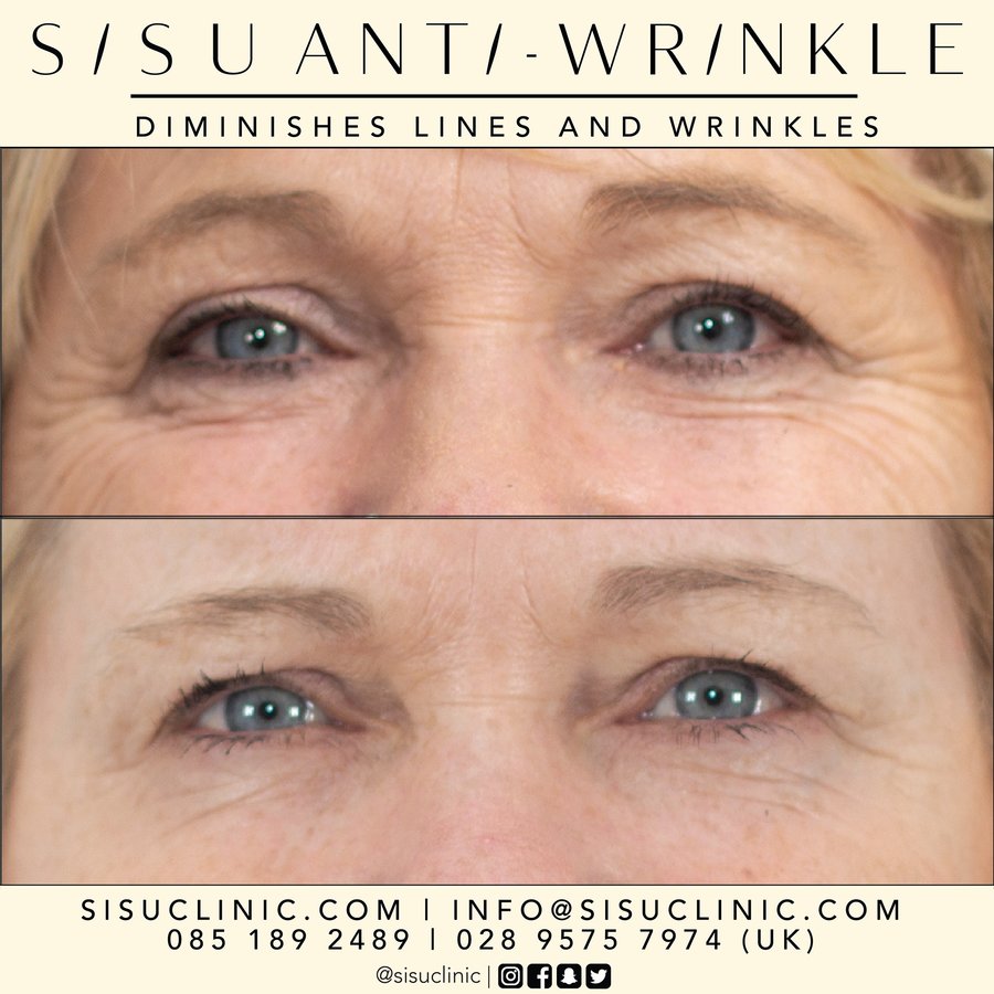 SISU Aesthetic Clinic - Cork - SISU Aesthetic Clinic - Cork