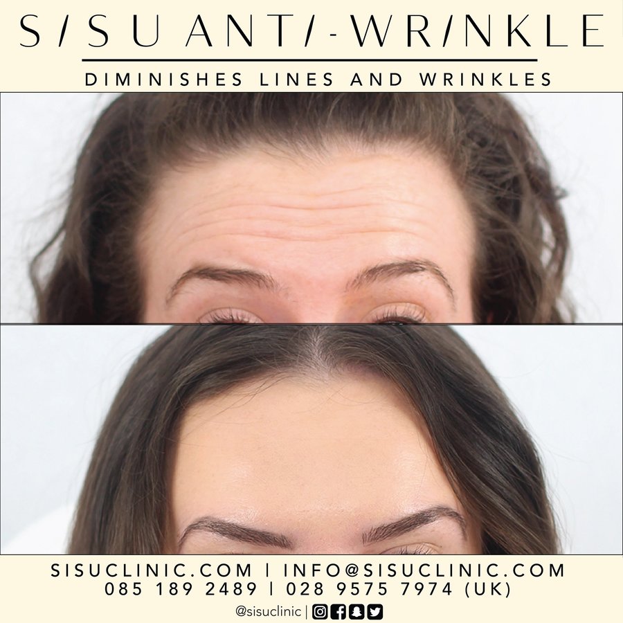 SISU Aesthetic Clinic - Cork - SISU Aesthetic Clinic - Cork