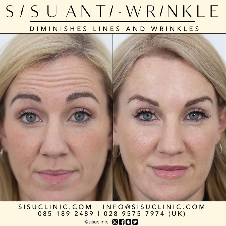 SISU Aesthetic Clinic - Cork - SISU Aesthetic Clinic - Cork