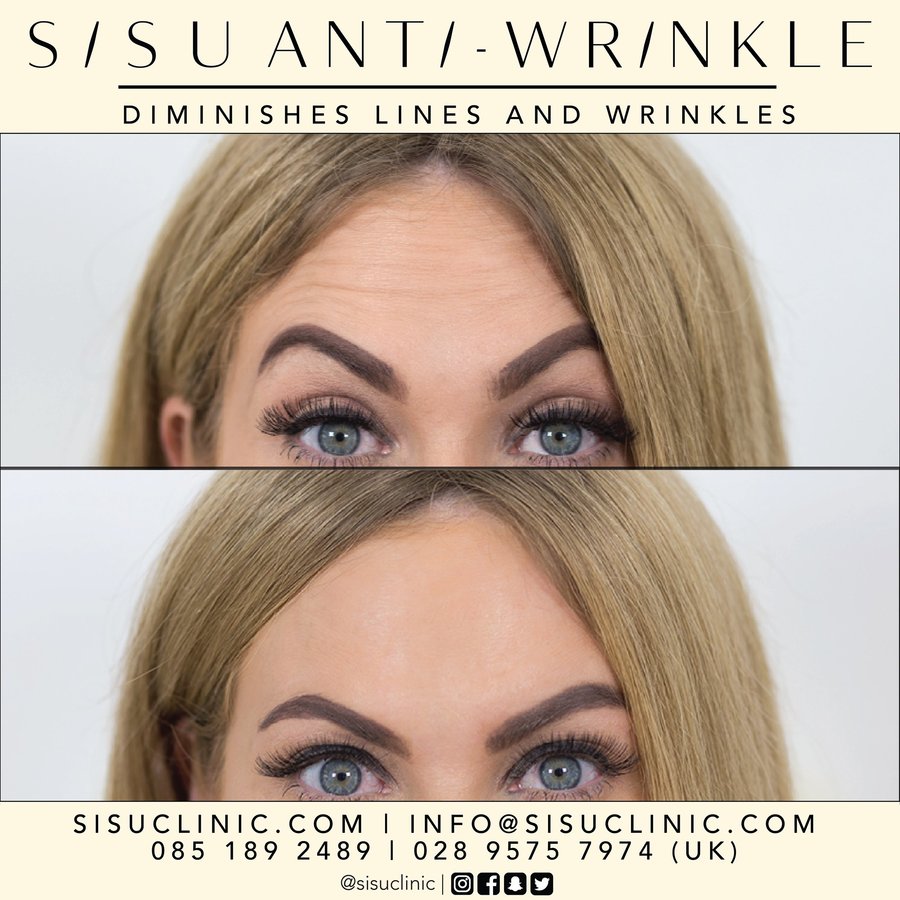 SISU Aesthetic Clinic - Cork - SISU Aesthetic Clinic - Cork