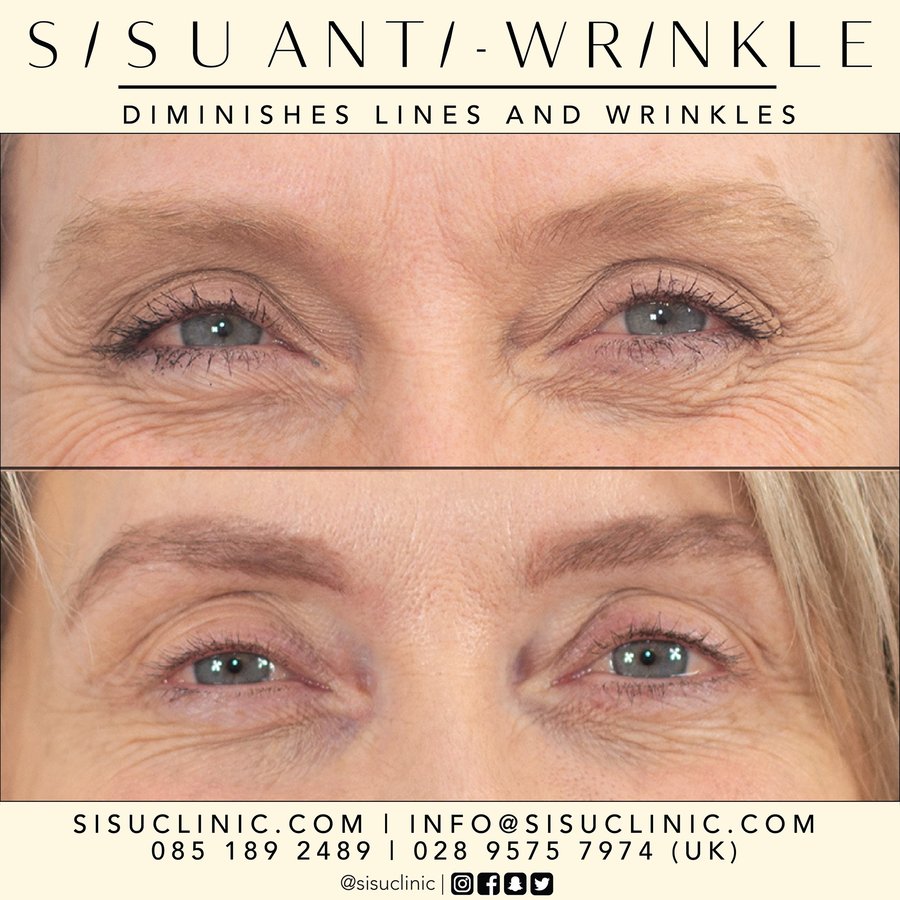 SISU Aesthetic Clinic - Cork - SISU Aesthetic Clinic - Cork