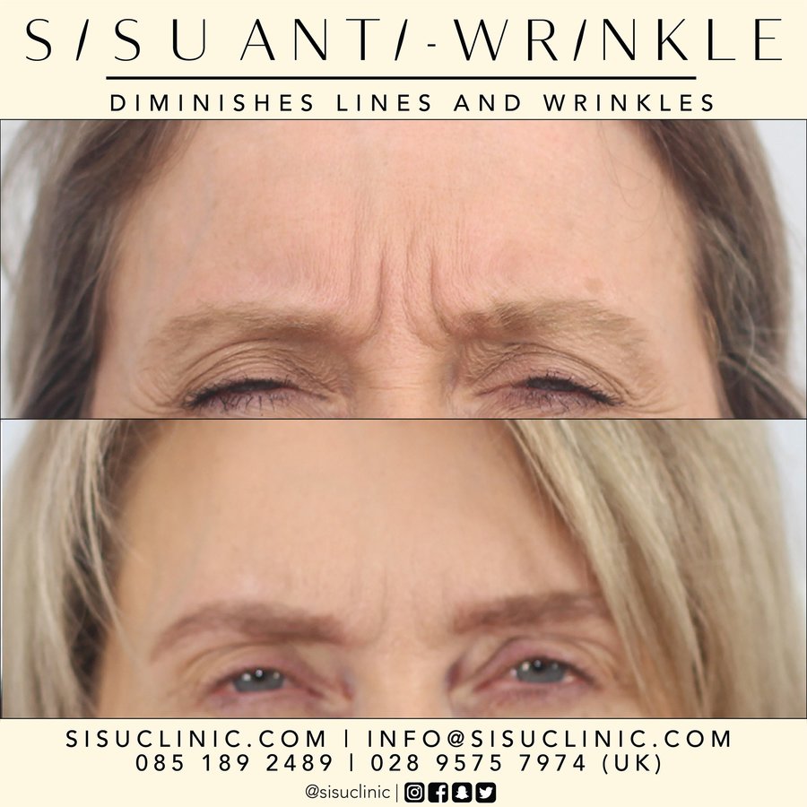 SISU Aesthetic Clinic - Cork - SISU Aesthetic Clinic - Cork