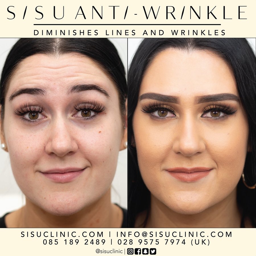 SISU Aesthetic Clinic - Cork - SISU Aesthetic Clinic - Cork