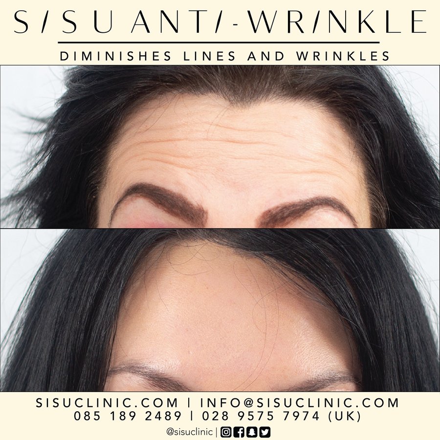 SISU Aesthetic Clinic - Cork - SISU Aesthetic Clinic - Cork