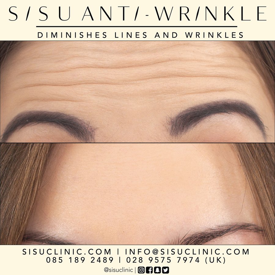 SISU Aesthetic Clinic - Cork - SISU Aesthetic Clinic - Cork