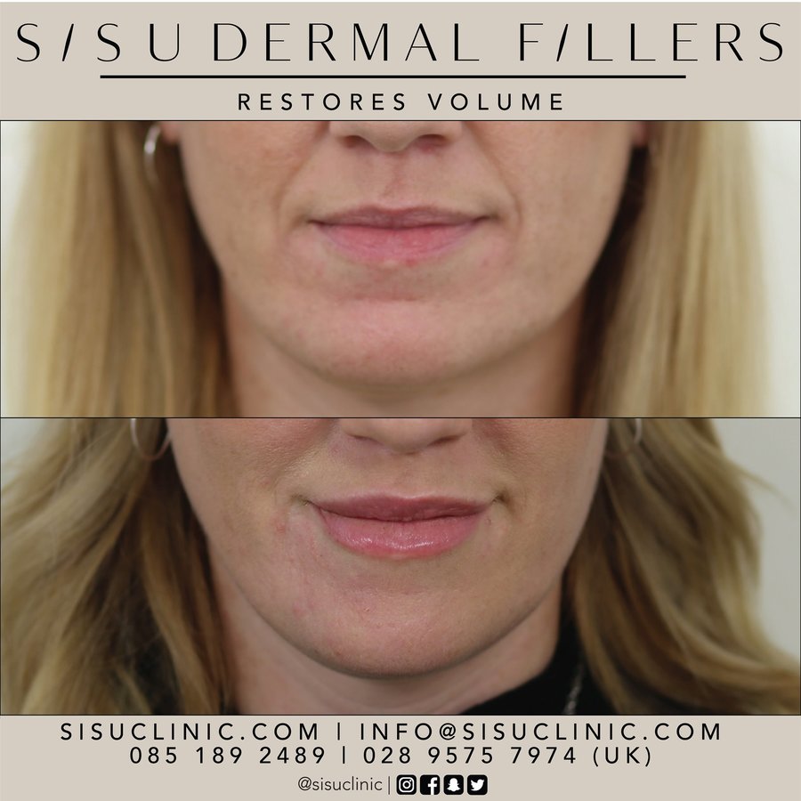 SISU Aesthetic Clinic - Cork - SISU Aesthetic Clinic - Cork