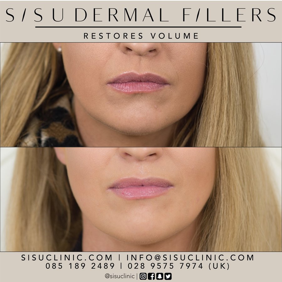 SISU Aesthetic Clinic - Cork - SISU Aesthetic Clinic - Cork