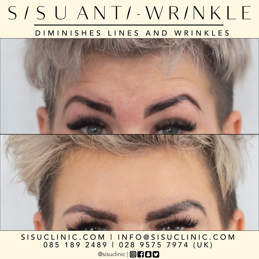 SISU Aesthetic Clinic - Cork - SISU Aesthetic Clinic - Cork