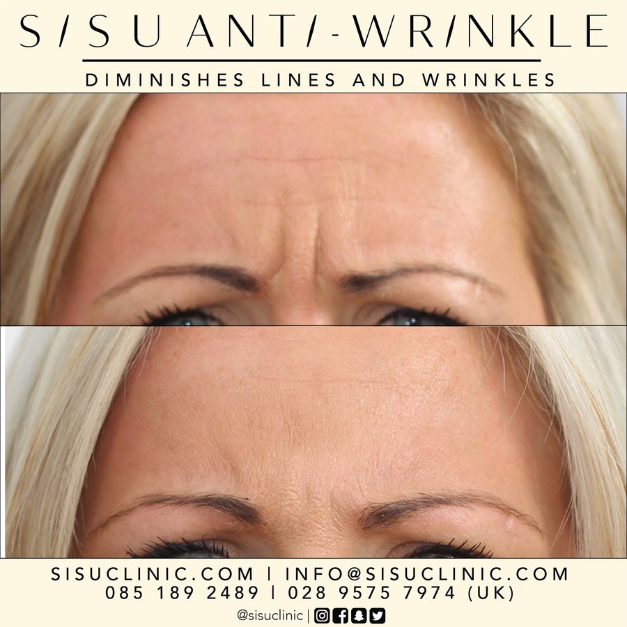 SISU Aesthetic Clinic - Cork - SISU Aesthetic Clinic - Cork
