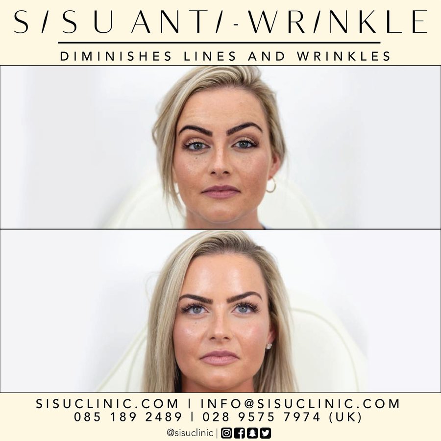 SISU Aesthetic Clinic - Cork - SISU Aesthetic Clinic - Cork