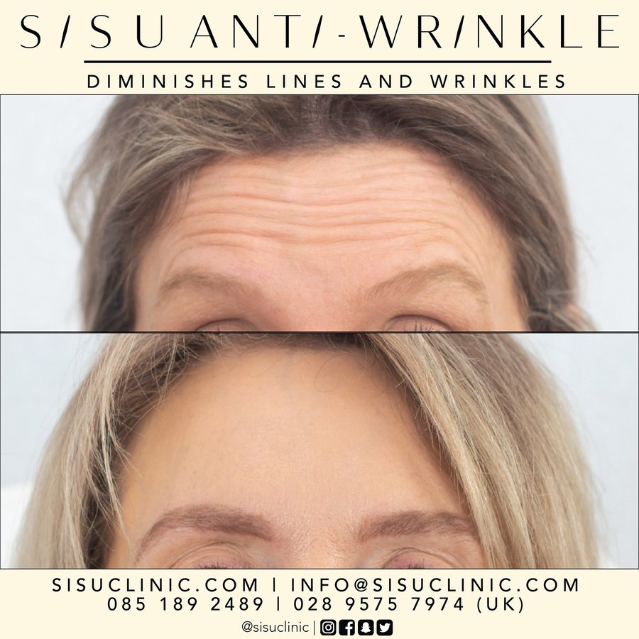 SISU Aesthetic Clinic - Cork - SISU Aesthetic Clinic - Cork