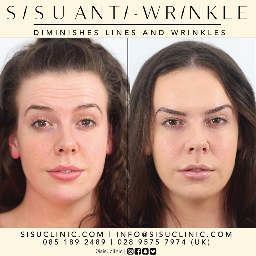 SISU Aesthetic Clinic - Cork - SISU Aesthetic Clinic - Cork