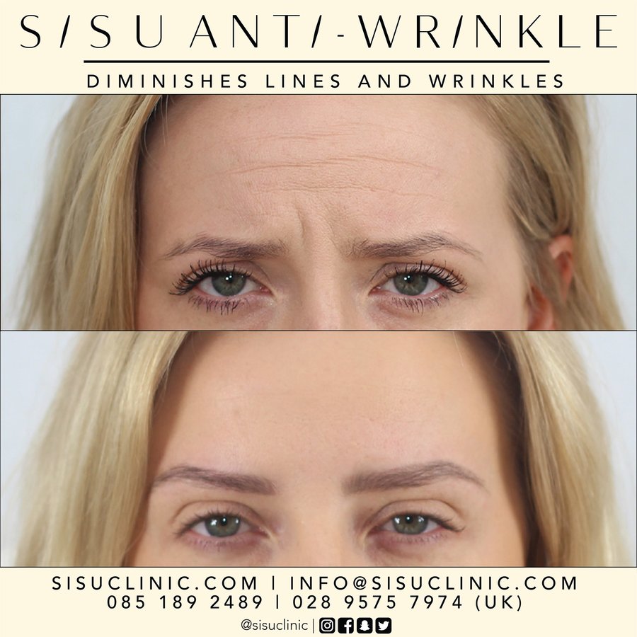 SISU Aesthetic Clinic - Cork - SISU Aesthetic Clinic - Cork
