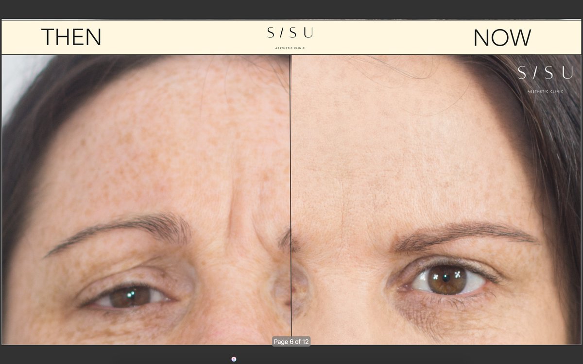 SISU Aesthetic Clinic - Dublin 2 - SISU Aesthetic Clinic - Dublin 2