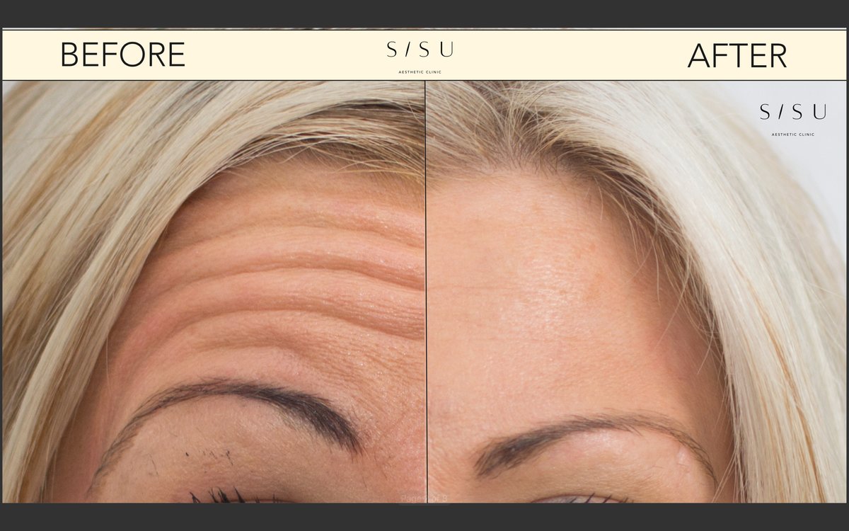 SISU Aesthetic Clinic - Dublin 2 - SISU Aesthetic Clinic - Dublin 2