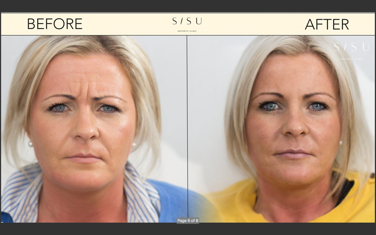 SISU Aesthetic Clinic - Dublin 2 - SISU Aesthetic Clinic - Dublin 2
