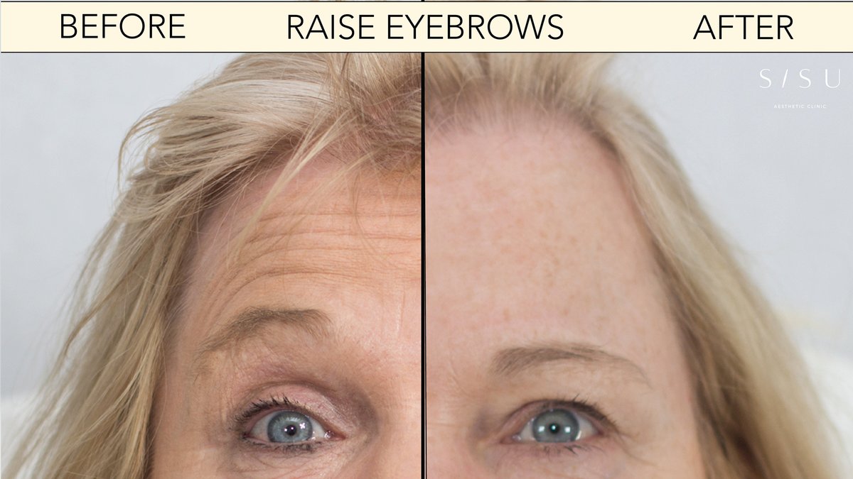 SISU Aesthetic Clinic - Dublin 2 - SISU Aesthetic Clinic - Dublin 2