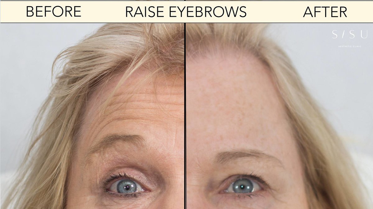 SISU Aesthetic Clinic - Dublin 2 - SISU Aesthetic Clinic - Dublin 2